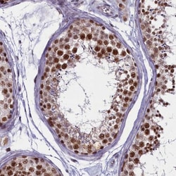 PPHLN1 Antibody, Novus Biologicals 0.1mL; Unlabeled:Antibodies, Polyclonal